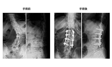 手術前と手術後