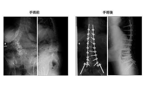 手術前と手術後